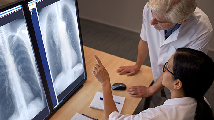 Технология Bone Suppression