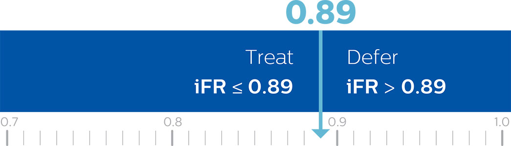 пороговое значение iFR