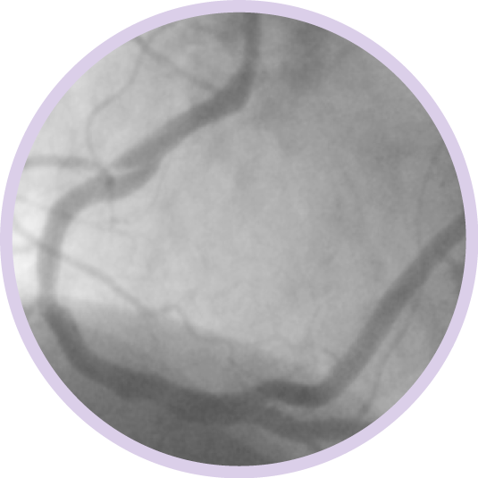 неоднозначная ангиограмма