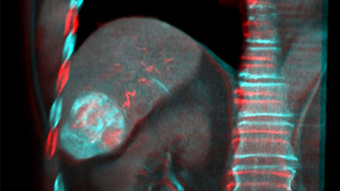 Объединение изображений с&nbsp;помощью Dual View