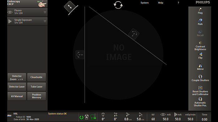 Асимметричная коллимация