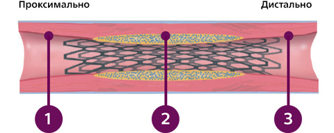 Три выявленных критерия ВСУЗИ