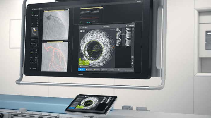 экраны медицинского устройства