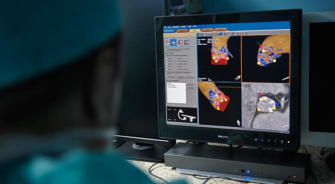 Сердечные дела: ошибка эволюции