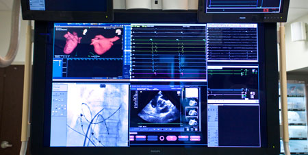 Как лечат сердце в XXI веке?